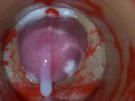 内射实录——体内镜头捕捉男性深喉射精 xhamster gay porn chinese