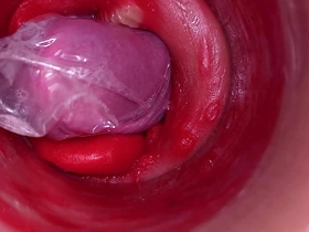 深入阴道的摄像头记录下带着套套的巨量射精 chinese gay security porn